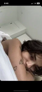 noordabs